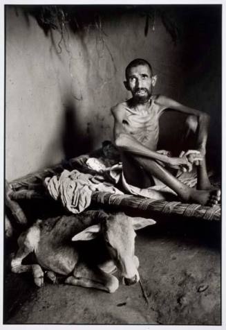 India. Bihar famine, 45 yr. old man dying of hunger