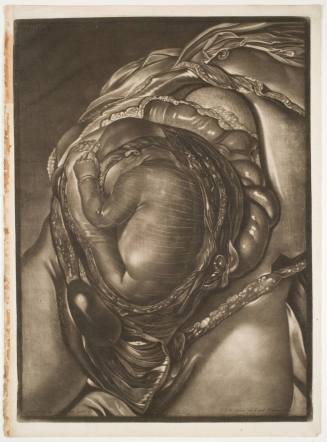 Demonstrations of a Pregnant Uterus of a Woman at Her Full Term, plate III