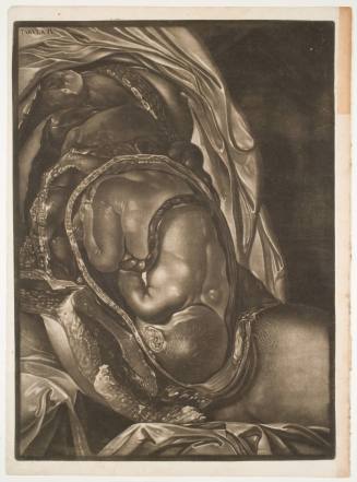 Demonstrations of a Pregnant Uterus of a Woman at Her Full Term, plate IV