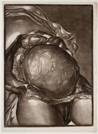 Demonstrations of a Pregnant Uterus of a Woman at Her Full Term, plate II